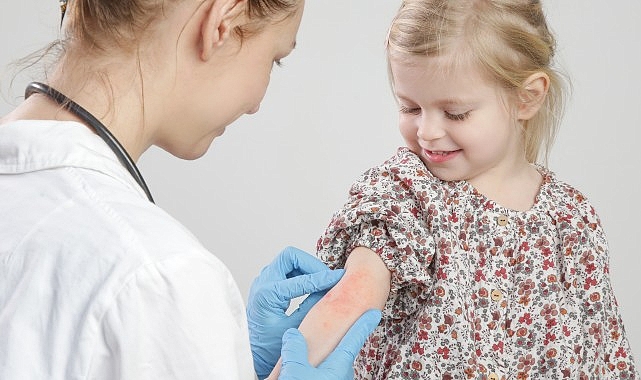 Alerji Testinin Olumlu Çıkması Etkin Bir Alerji Olduğunu Göstermeyebilir!